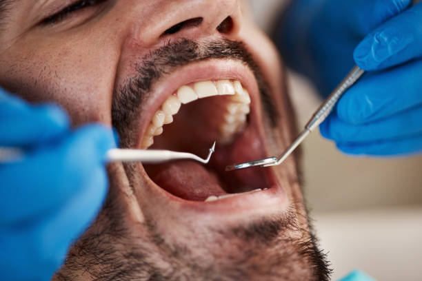 Best Emergency Treatment for Oral Infections in Montrose, VA